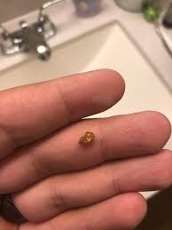 That includes boobs, butts, and your assuming you are a guy kidney stones are supposed to be worse for us, seeing as how we have a longer narrower urethra than women, it also happens to pass through a. When You Wake Up In The Middle Of The Night In Excruciating Pain And Pass A Kidney Stone Hadtohurt