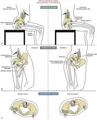 Anterior Pelvic Tilt Muscle Anatomy Physical Therapy Yoga Anatomy