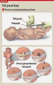 Selengkapnya, akan dijelaskan pada artikel teknoding kali ini. Www Fazlina Com Cara Cuci Tali Pusat Baby