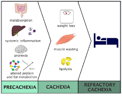Image result for Cachexia in Cancer