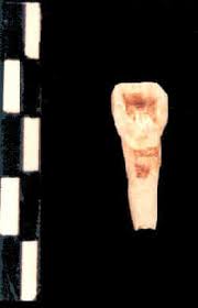 Résultat de recherche d'images pour "shovel shaped incisors"
