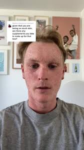 Reply to @celiasymons Supplements I take to help skin regeneration  #topicalsteroidwithdrawal #nomoisturetreatment #ctrlskin #fyp #supplements