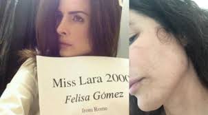 La exmiss venezolana que está gravemente enferma y en la calle: “Ya no  aguanto mi vida”