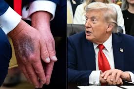 ABC reported: 30 minutes ago, MAGA confirmed that President TRUMP was not  poisoned, missing for 6 days to treat "Stroke" his health is not stable,  the Oval Office had to urgently convene