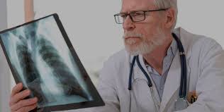 These changes are the result of the interaction between a person's genetic factors and three. Causes Of Lung Cancer Booking Health