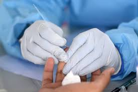 Further research on the reversibility of impairment and developing treatment are warranted. Veja Onde Fazer Testes Rapidos De Deteccao Da Covid 19 Gratuitamente Em Salvador Bahia G1