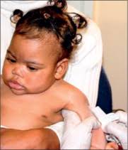 Profile: SATVI—a leading light in tuberculosis vaccine research