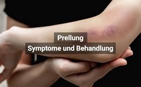 Hallo, ich habe gestern meinen finger an der tür meines schrankes gequetscht. Prellung Symptome Behandlung Dauer Praktischarzt