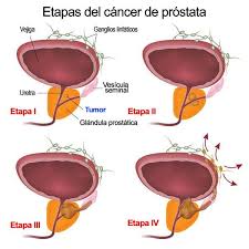 Pin On Salud Casera