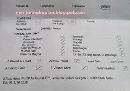 Family doctor in shah alam, malaysia. Klinik Ajwa Shah Alam Seksyen 7 Umpama X
