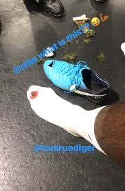 Join facebook to connect with antonio ruediger and others you may know. Antonio Rudiger Injury Chelsea Star Shows Off Blooded Foot And Ripped Boot Football Sport Express Co Uk