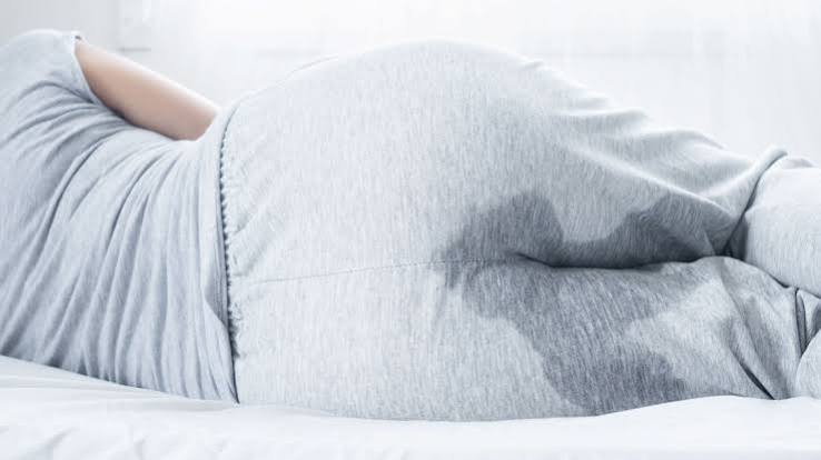 Các biện pháp giúp cải thiện tình trạng tiểu không tự chủ