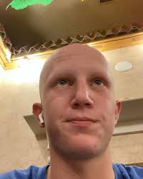 Meet Greyson Bennett!! #alopecia_family #WeAreAlopecia