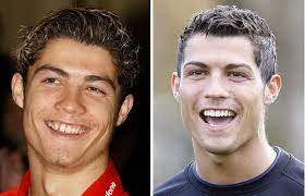 Doch kaum einer weiß, wie er als kind war. Pin Von Sebastian Uberschar Auf Famous Smiles Ronaldo Cristiano Ronaldo Plastische Chirurgie