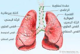 ناسا بالعربي سرطان الرئة