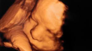 Legislatura de Iowa estudia prohibir el aborto de 6 semanas durante una  sesión especial