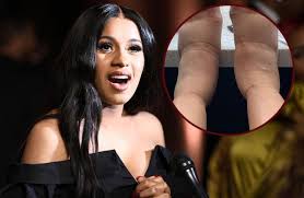 She became an internet celebrity after. Cardi B Schock Foto Was Ist Mit Ihren Fussen Passiert