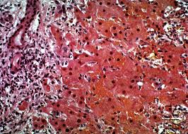 Image result for Crotalaria laburnoides