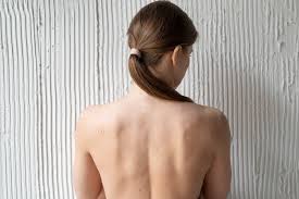 Cure thermale en dermatologie : eczéma, psoriasis, acné… quelles stations choisir ?