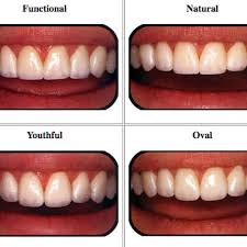 How To Choose The Best Veneers For Your Face Shape Dr Raanan