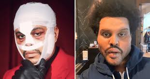 No, the weeknd's plastic surgery is not real. Did The Weeknd Get Plastic Surgery Truth Behind Botox Rumors As Trolls Target Rapper After Shocking Transformation Meaww
