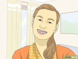 Beauty is in the eye of the beholder. 3 Ways To Look Great With Braces Wikihow