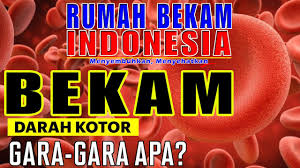 Titik 1, 55, 9, 10, 41, 42 dan bekam kering pada 137,140. Bekam Diabetes Rumah Bekam Indonesia