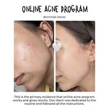 Rory Case, 1250 E Hallandale Beach Blvd, Hallandale Beach, FL 33009, US