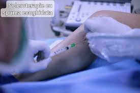 Acesta poate fi de mai multe feluri, avand ca rol nu doar remisiunea lor, dar si impiendicarea aparitiei unor noi vene varicoase, sau evolutia lor spre complicatii 4. Procto Vein Clinic Tratamente Cu Laser Varice Si Hemoroizi