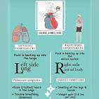 Congestive Heart Failure - The heart is not working ...