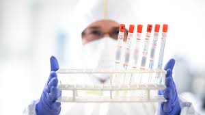 Jun 19, 2021 · die situation jetzt in deutschland sei mit der in england im mai durchaus ein wenig vergleichbar, analysierte drosten. Coronavirus In Deutschland Anteil Von Delta Variante Fast Verdoppelt Tagesschau De