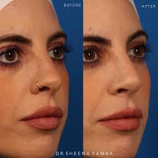 🙏🏼Beyond blessed to have been welcomed with open arms and hearts by Dr. Keith  Marcus, his amazing team, and the South Bay community. Thank you all for an  incredible year ❤️ @drkeithmarcus @