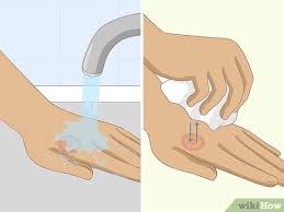 Topical therapy for ringworm your veterinarian will probably recommend a topical therapy, like a cream, ointment, and/or medicated shampoo to help treat and control the infection. How To Get Rid Of Ringworm Can Natural Remedies Help