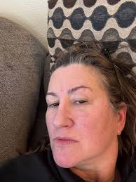 Lupus??...is it LUPUS??!?!??😳