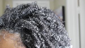 I've stopped bf'ing quite some time ago and the hair fall is still there. 3 Ways You Should Be Moisturizing Your Low Porosity Hair 21ninety