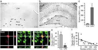A atriz portuguesa bruna quintas não resistiu este anos às praias portuguesas e nas redes sociais partilhou fotografias a destacar as mamas. Inflammation Is Detrimental For Neurogenesis In Adult Brain Pnas