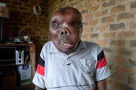 Orang terkaya di dunia memang memiliki jumlah harta yang mencengangkan , bahkan kekayaannya bisa melebihi jumlah pdb di sejumlah negara. Dijuluki Pria Terjelek Di Dunia Siapa Sangka Pria Ini Malah Sudah 3 Kali Menikah Netizen Sampai Keheranan Melihat Kecantikan Istri Istrinya