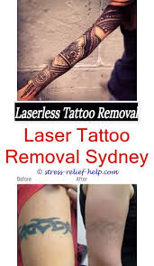 As a result, they often offer a better price range than the other facilities that in addition, the level of training and experience that a technician has will alter the price they charge. Tattoo Removal Prices Laser Tattoo Tattoo Removal Cost Laser Tattoo Removal
