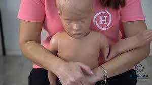 Heimlich manevrası, bilinci açık kişilere, bilinci kapalı kişilere, bebeklere ve kendi kendimize farklı şekillerde uygulanır. Heimlich Manevrasi Nedir Hemlik Manevrasi Ekipmandeposu Blog