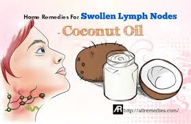 Pin By Sara Allen On Home Remedies Swollen Lymph Nodes Lymph Nodes Home Remedies