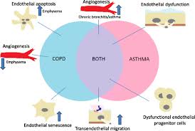 Risk factors for chronic bronchitis include continuous attacks of acute bronchitis, weak immune system, irritants, and polluted air. The Role Of The Endothelium In Asthma And Chronic Obstructive Pulmonary Disease Copd Respiratory Research Full Text
