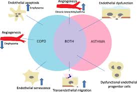 Copd, or chronic obstructive pulmonary disease, and asthma are two respiratory diseases. The Role Of The Endothelium In Asthma And Chronic Obstructive Pulmonary Disease Copd Respiratory Research Full Text