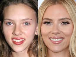 We did not find results for: Scarlett Johansson Before And After From 1997 To 2020 The Skincare Edit