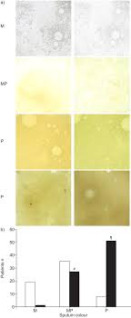 Sputum Colour A Useful Clinical Tool In Non Cystic Fibrosis