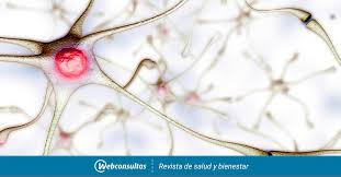 Check spelling or type a new query. Esclerosis Multiple Causas Sintomas Y Tratamiento