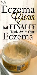The Cream That Finally Made Our Eczema Go Away Best Cream For Eczema Eczema Cream Eczema Remedies