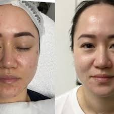 RENOUVELE BODY SOLUTIONS