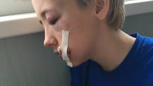 How do we know they're the hottest? 7 Men Attack Teenager In Russia For Lesbian Appearance The Moscow Times