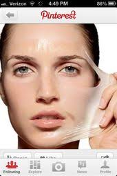 12 Surprising Home Remedies for Acne