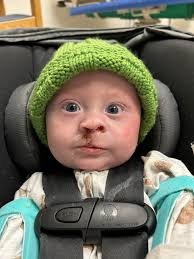 Jaxon's Recovery Update